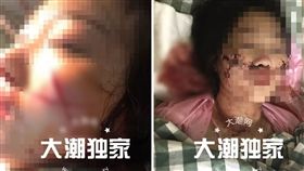 （圖／翻攝自海寧大潮網）恐怖情人,毀容,開山刀,中國