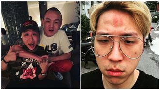 慶生淪鬥毆亮槍？滿臉血的大根回應了