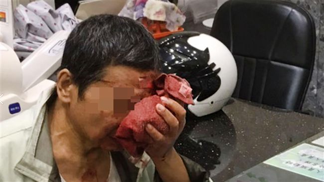 男跌破頭抹香灰　滿臉血求助警送醫