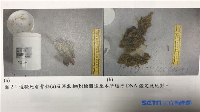 港女箱屍案　檢體中的小骨頭照首曝光
