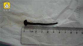 女孩氣管中躲藏水蛭，導致她呼吸困難。（圖／翻攝自梨視頻）