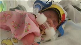 澳洲,伯斯,可樂,椰子油,早產兒 圖/翻攝自7news
