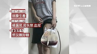 婦找名醫剖腹　子宮破洞掛尿袋9個月