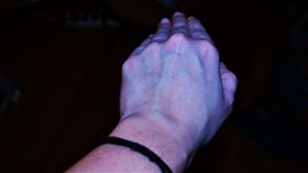 青筋
https://www.flickr.com/photos/130528286@N07/17020253132/in/photolist-rW2fhd-T9N83-4tm8Tc-4VRiq-fyodkX-davQeW-H6cuvU-57Duu3-ayAeSX-9C1xJQ-csfq9w-zs5Pfo-6NHiq8-8AcC14-W6yXYw-5gxto7-6s21r6-9PyDZx-7HQi