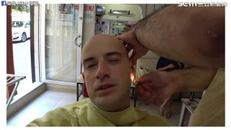 直擊土耳其理髮院　火除耳毛驚呆網友