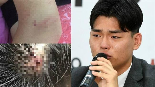 韓團遭公司暴打4年　今正式報警提告