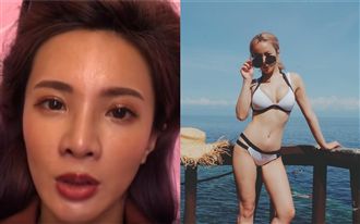 網紅子宮頸癌前病變　追蹤4次竟惡化