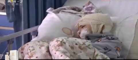 8歲女遭8狗圍攻亂咬　左眼拔出狗牙