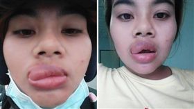 （圖／翻攝自E`Noonizzy Niz臉書）泰國,鹽酥蝦,過敏,香腸嘴,勸世