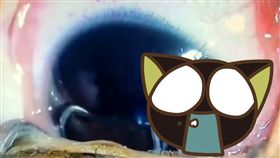 寄生蟲,眼睛,線蟲,寵物,中國,大陸,陝西,感染,衛生,　圖／翻攝自微博　