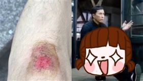 葉問,腿傷,大陸,馬桶,亞洲蹲,功夫,廁所,武功,中國　圖／翻攝自微信