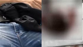 睪丸,切除,手術,扭轉,壞死,360度,大陸,廣州,湛江　圖／翻攝自看看新聞　https://goo.gl/Vz9Hfe