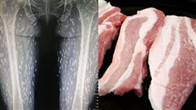 女生吃豬肉 身體長出數百隻寄生蟲！X光照嚇死人（圖／臉書，ＰＩＸＡＢＡＹ）