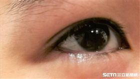 眼睛（示意圖非新聞當事人／記者楊晴雯攝）