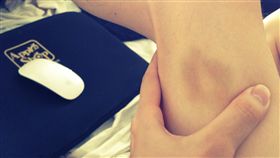 瘀青
https://www.flickr.com/photos/takahashir/8360013740/in/photolist-qXUrTW-dJKfPW