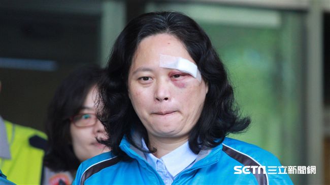 眼眶瘀青出院！賴香伶：我不會被打倒