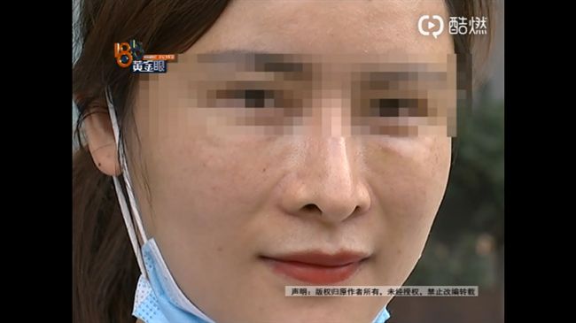 女模砸40萬整鼻　女兒見她喊：怪物