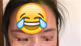 貼紙,HAPPY,曬傷,路跑,／翻攝自爆廢公社