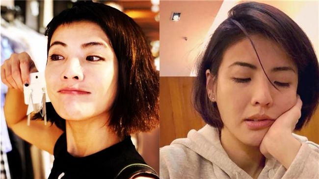 腰痛不理…女星驚爆：晚一步腎臟壞掉