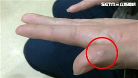 博元婦產科,蔡鋒博,菜花,手淫