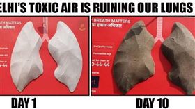 新德里霧霾慘　人工肺十日內變深褐色
（圖／翻攝自Help Delhi Breathe臉書）