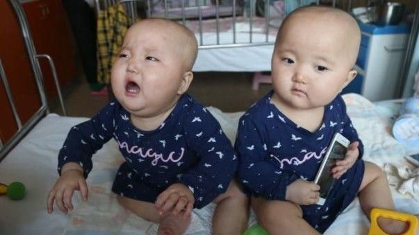 雙胞胎女嬰患白血病　賣房只夠救一個
