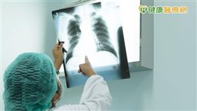 根據台大醫院新竹分院資料顯示，超過五成患者在初診斷罹患肺癌時，癌細胞就已經發生轉移，其中至少三成病患，都會出現「骨轉移」，也就是癌細胞跑到骨頭的問題。