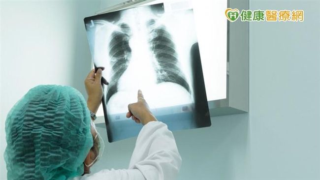 肺癌骨轉移別輕忽　骨折癱瘓得不償失