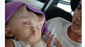 （圖／翻攝自The Sun）菲律賓,嬰兒,犄角,魔鬼,無腦畸形症