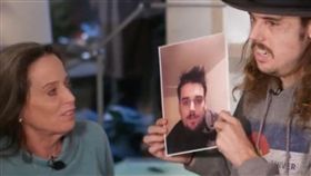 憂鬱症,整形,手術,自殺,酒癮,毀容,重生, 　圖／翻攝自推特　