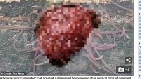 美國,蟲,人腦,噁心