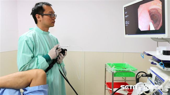 無痛大腸鏡腸穿孔風險高？醫這樣分析