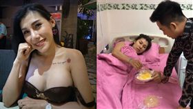 終身保固,義乳,整形,隆乳,醫院,醫美,破裂,爆炸,越南,飛機,　圖／翻攝自Afamily