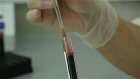 HIV,病毒,加拿大,愛滋病,研究,突變,潛伏期,發病,Saskatchewan, 圖／翻攝自pixabay　https://goo.gl/BDNx62