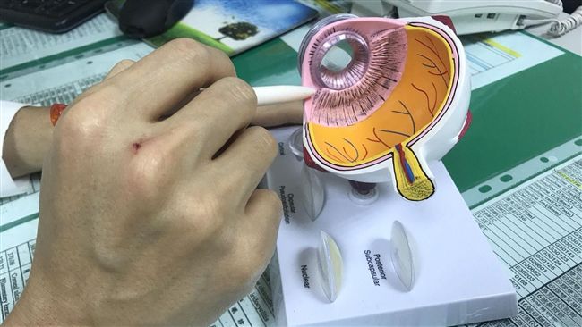 散瞳劑可以改善近視嗎？醫生這樣說