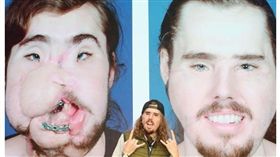 （圖／翻攝自鏡報）美國,憂鬱症,自轟,臉部,重建