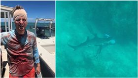 美國男遭鯊魚咬頭。（圖／翻攝Will Krause臉書）