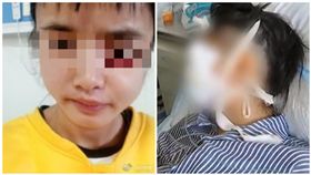 大陸,蛀牙,眼球,腐蝕,密醫(圖/翻攝自看看新聞)