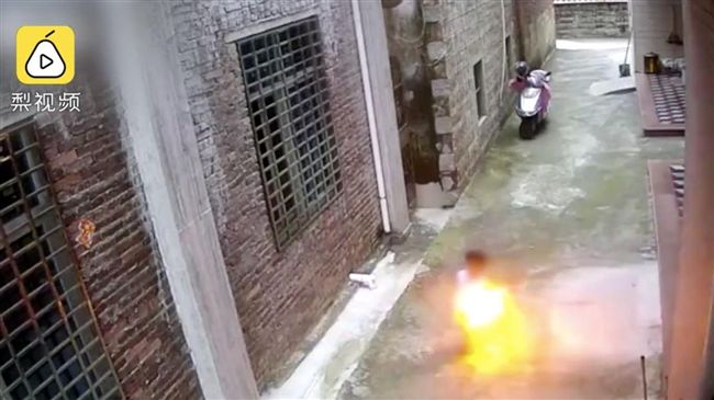男童點火燒裙子　女童被燒到頭頸相黏