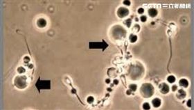 抗體,生小孩,彰化市博元婦產科,蔡鋒博,不孕,精蟲抗體
