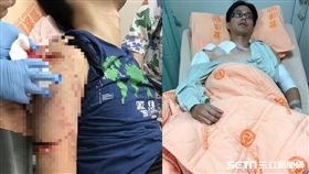 女持鐮刀砍殺 警員手臂肌肉遭削掉／翻攝畫面