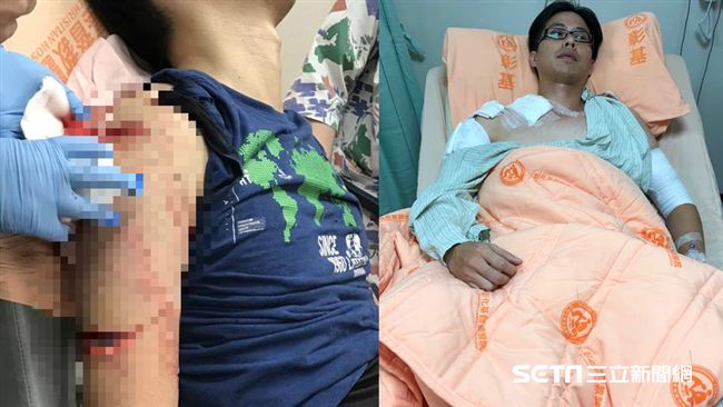 女持鐮刀砍警前　當街攻擊學童