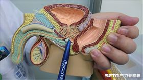 筆所指處即為攝護腺位置。（圖／童綜合醫院提供）