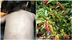 數珠珊瑚,珊瑚珠,紅疹,皮膚科,毒素(圖/翻攝自爆料公社)