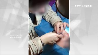 「行刑」畫面曝！她用倒鉤針縫雙眼皮