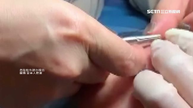 上海醫隔柵欄替人拆線　網轟：鬼封城