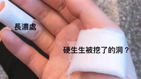 膿包,長痣,開刀,過失,生命危險（圖／翻攝自爆怨公社臉書）