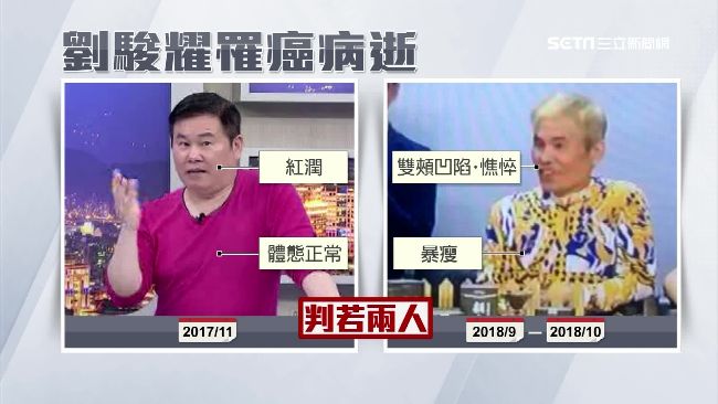 癌王胰臟癌　五位患者就一位放棄治療