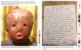 烏茲別克,男童辛卓夫（Bakhtiyer Sindrov）,燒傷,毀容,聖誕願望（圖／翻攝自太陽報）