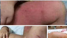 桃園,虐童,毒打,偷偷,就醫,